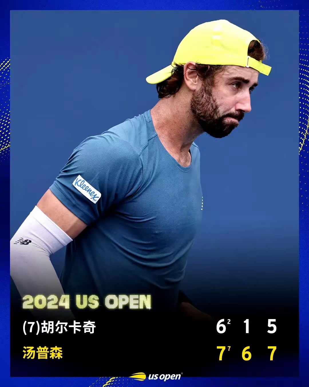 包含美网翻盘年终总决赛，辛纳关键制胜的词条